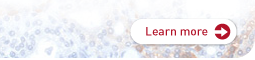 Learn more about the MicroChIP seq kit