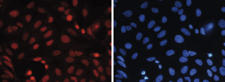 Immunofluorescence figure D