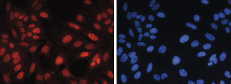 Immunofluorescence figure B