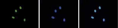 H3R17me2(asym)K18ac Antibody validated in Immunofluorescence