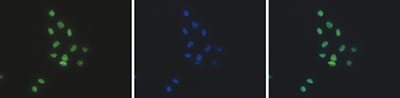 H2BK12ac Antibody validated in Immunoflurescence