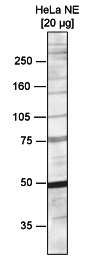 Western blot