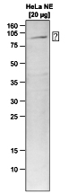 Western blot 