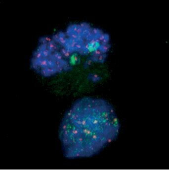 H4K20me3 Antibody validated in Immunofluorescence