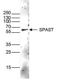 Western blot figure 1
