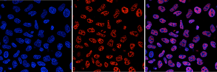 Immunofluorescence