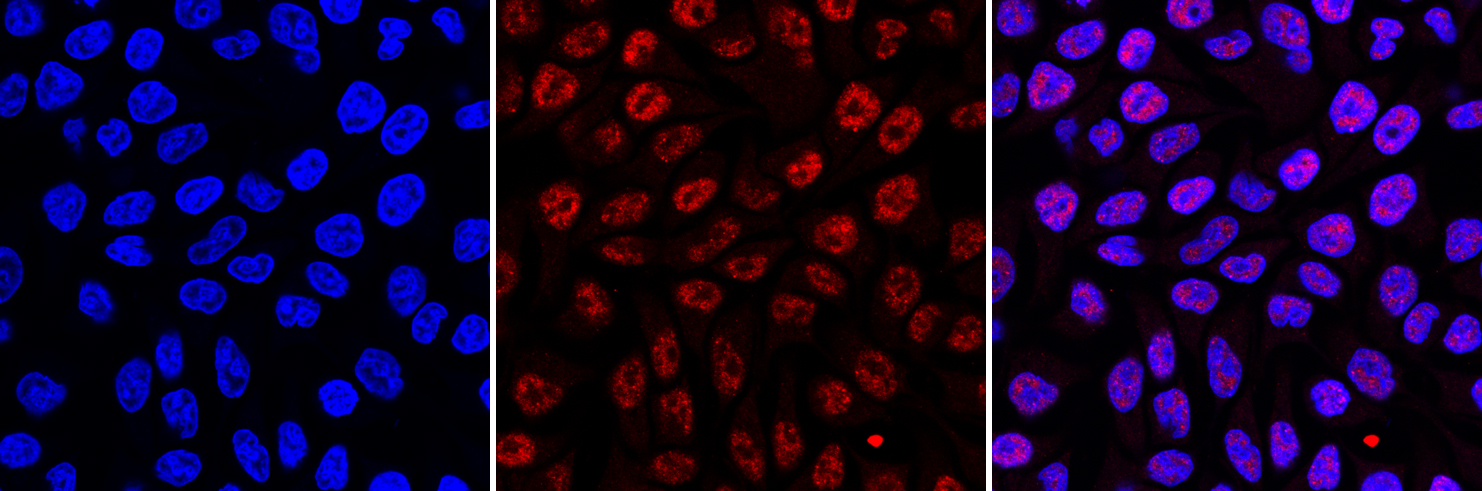 5-methylcytosine (5-mC) Antibody for IF