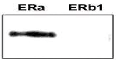 ER alpha Antibody validated in Western Blot