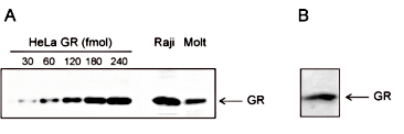 GR Antibody validated in Western Blot