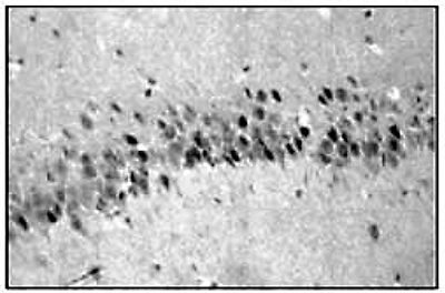 GR Antibody validated in Immunohistochemistry