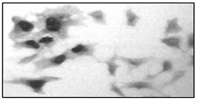 GR Antibody validated for Immunohistochemistry