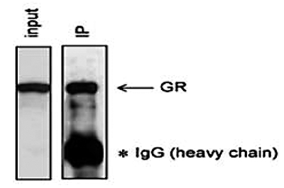 GR Antibody validated in Immunoprecipitation