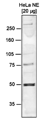 Western blot