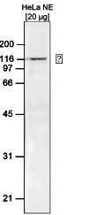 Western Blot