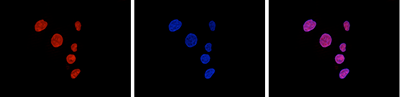 HDAC1 Antibody validated in Immunofluorescence