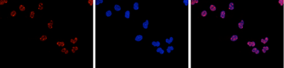 HDAC3 Antibody validated in Immunofluorescence