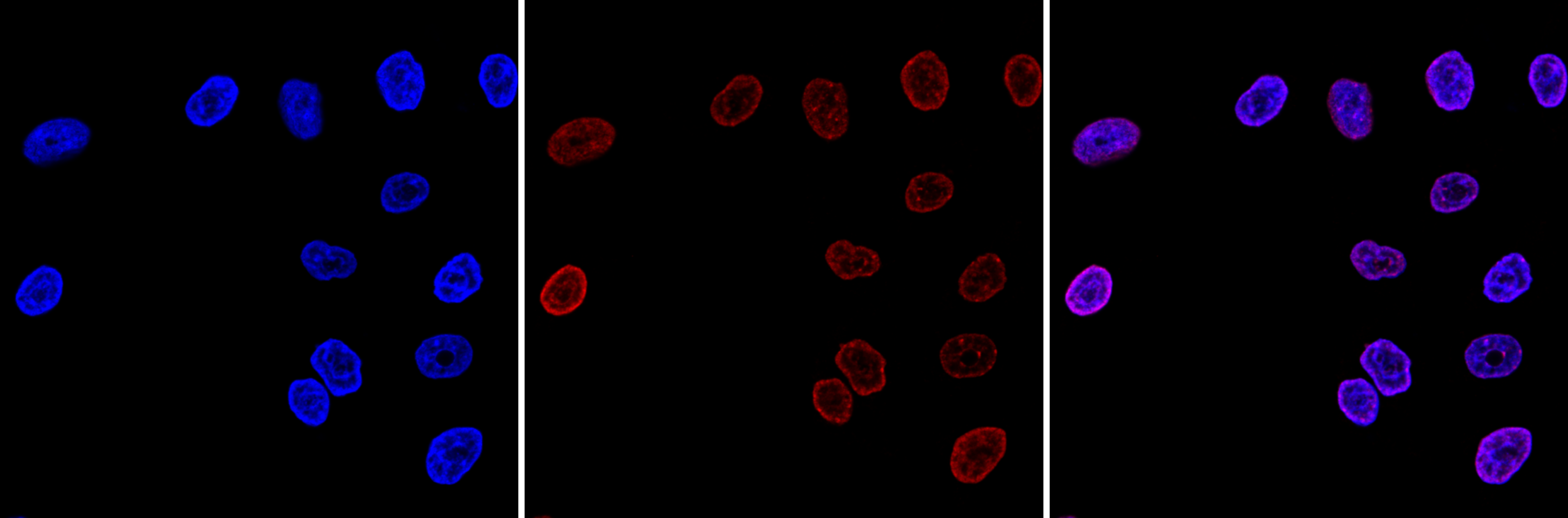 H3K9me3 Antibody validated in Immunofluorescence