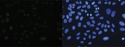 H4K20me1 Antibody validated for Immunofluorescence