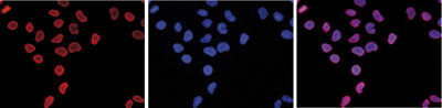 H3K4un Antibody validated in Immunofluorescence