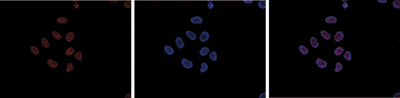 H3K4me1 Antibody validated in Immunofluorescence