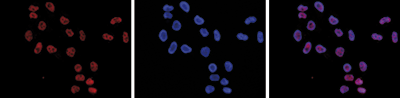 H3K4me2 Antibody validated in Immunofluorescence