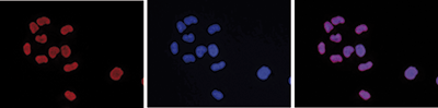 H3K9me3 Antibody validated in Immunofluorescence