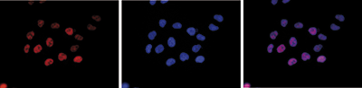 H3K9un Antibody  validated in Immunofluorescence