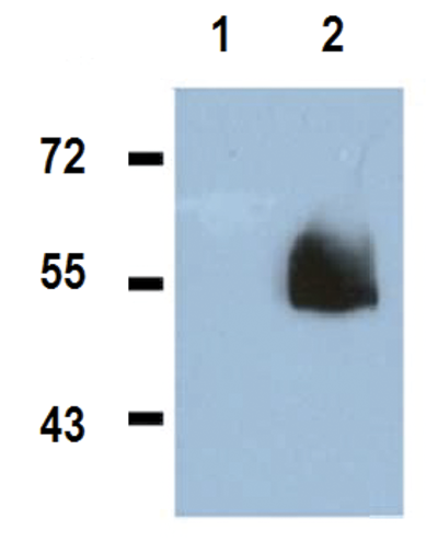 Western Blot