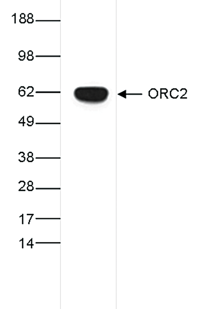 Western Blot