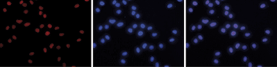 HDAC2 Antibody validated in Immunofluorescence