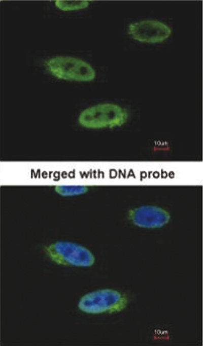 RbAp48 Antibody validated in Immunofluorescence