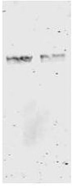 Western Blot