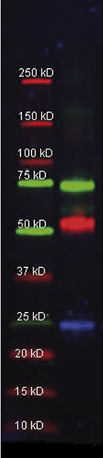 Western Blot