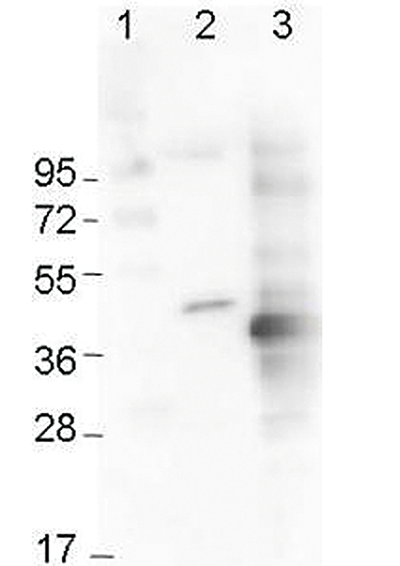 Western Blot