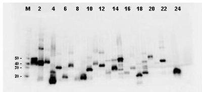 Western Blot