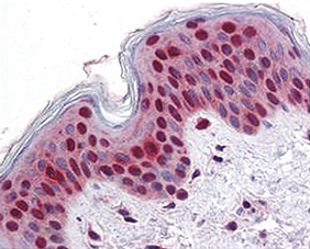 immunohistochemistry