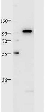 Western Blot