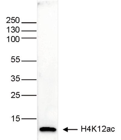 Western Blot