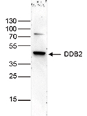 Western blot