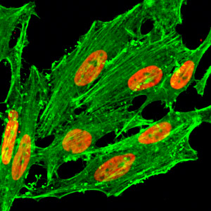 H2A.ZK7ac Antibody validated in Immunofluorescence 