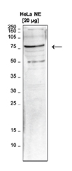 Western blot