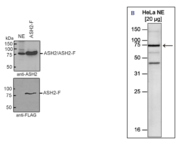 Western blot