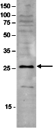 Western blot