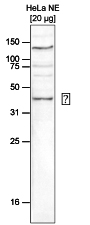 Western blot