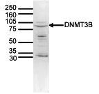 Western blot