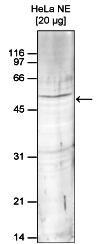 Western blot