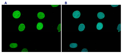H3K9me1 Antibody validated in Immunofluorescence