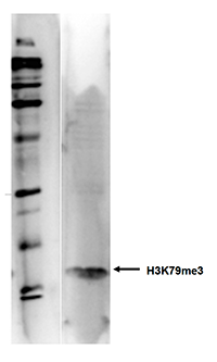 Western Blot