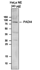 Western blot