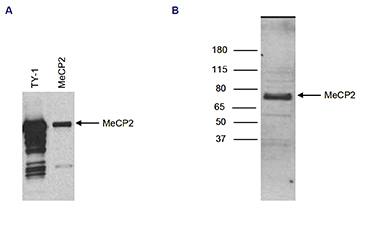 Western blot